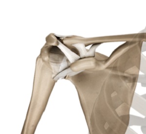 Acromioclavicular (AC) Joint Reconstruction1